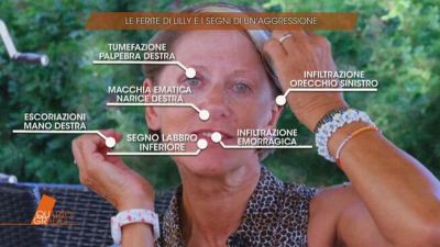 Le ferite di Lilly e i segni di un'aggressione