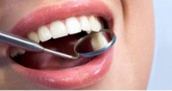 Studio dentistico GIAMPAOLO BOSI  igiene dentale