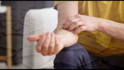 Da Almirall nuovo anticorpo monoclonale contro dermatite atopica