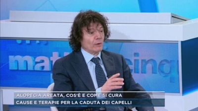 Alopecia areata, cos'è e come si cura