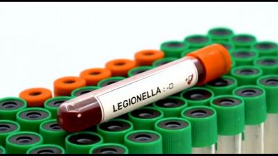Legionella rischio nascosto, prevenzione fattore fondamentale
