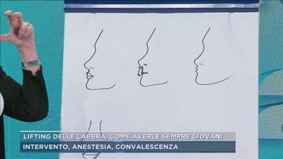 Lifting delle labbra, come averle sempre giovani