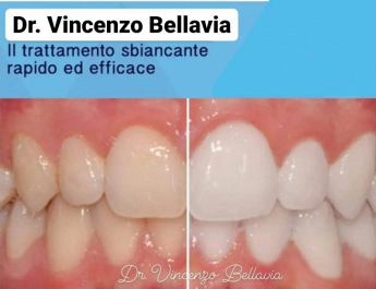 Bellavia dott Vincenzo odontoiatria - studio dentistico dentista per bambini favara