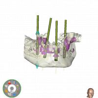Resize automatico da 14197273