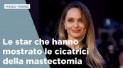 Mastectomia, non solo Angelina Jolie, ecco le star che hanno mostrato le cicatrici