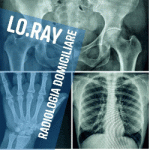 Lo Ray Radiologia Domiciliare