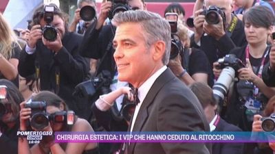 Chirurgia estetica: i vip che hanno ceduto al ritocchino
