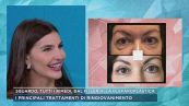 Sguardo, tutti i rimedi, dal filler alla blefaroplastica