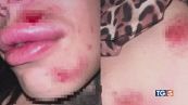 Due amiche transgender aggredite dal branco