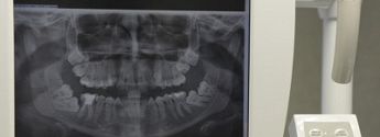 Panoramica arcata dentale