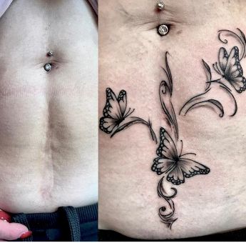 Focacci Tattoo & Piercing - Copertura cicatrice tattoo