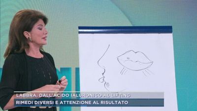 Labbra, dall'acido ialuronico al lifting