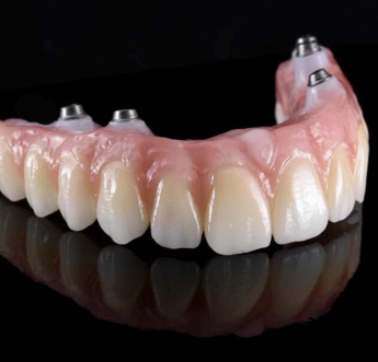 A. L. DENTAL SMILE - Impianti dentali