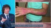 Psoriasi, una malattia della pelle di origine autoimmune