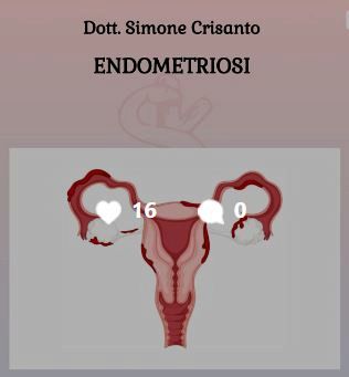 cura endometriosi
