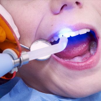 dentista per bambini studio dentistico Oria Andrea