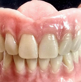 A. L. DENTAL SMILE - Protesi dentarie