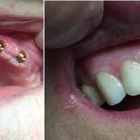 Resize automatico da 14197277