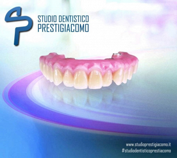Studio Dentistico Prestigiacomo PROTESI DENTALE