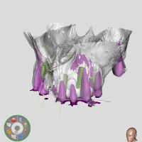 Resize automatico da 14197276