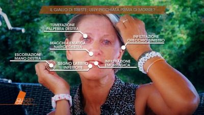 Liliana Resinovich è stata picchiata prima di morire?