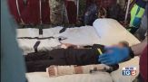 Arrivati da Gaza negli ospedali italiani