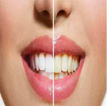 Studio Dentistico 03 - ortodonzia estetica
