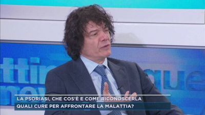 La psoriasi, che cos'è e come riconoscerla