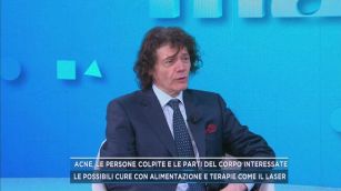 Acne, le persone colpite e le parti del corpo interessate