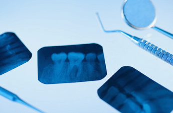 Studio Dentistico Pavan Dr. Rossana cure dentali