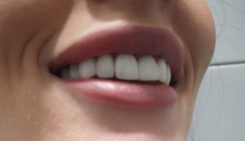 restituisci un sorriso dentale STUDIO DENTISTICO DAMANTE