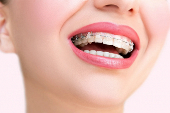 Il Sorriso Studio Dentistico ORTODONZIA E GNATOLOGIA