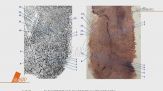 Garlasco: il giallo dell'impronta 33
