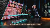 Il giallo di Lilly: l'analisi delle ferite