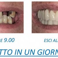 ᐅ Centro Implantologia Dentale Dr. Marco Parravano a L'Aquila (AQ)